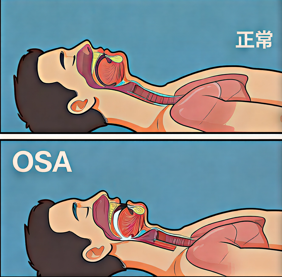 科普 | 从“提前洗漱”到“整夜安睡”：一场睡前仪式革命，藏着睡眠自由的答案(图3)