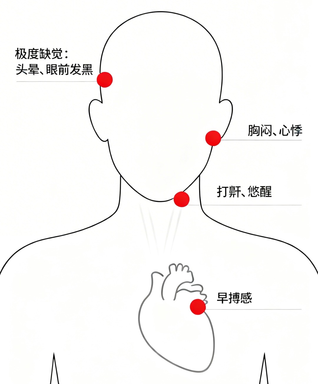 别让熬夜透支生命：睡眠与猝死的科学真相(图14)